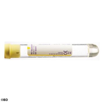 BD Vacutainer ACD Glasröhrchen 8,5 ml, für die Blutgruppenbestimmung