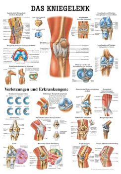anat. Lehrtafel: Das Kniegelenk 70 x 100 cm