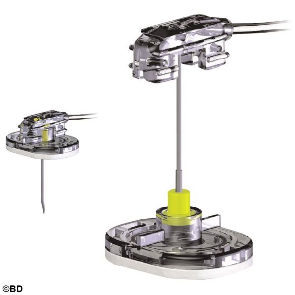 SafeStep Huber Nadelset zur Portpunktion ohne Y-Adapter