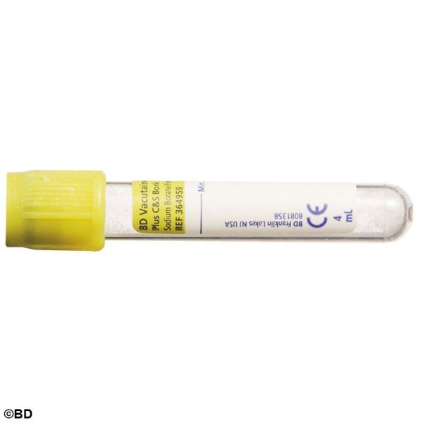 BD Vacutainer Urinröhrchen aus PET, inklusive Urintransfereinheit (50 Stck.)