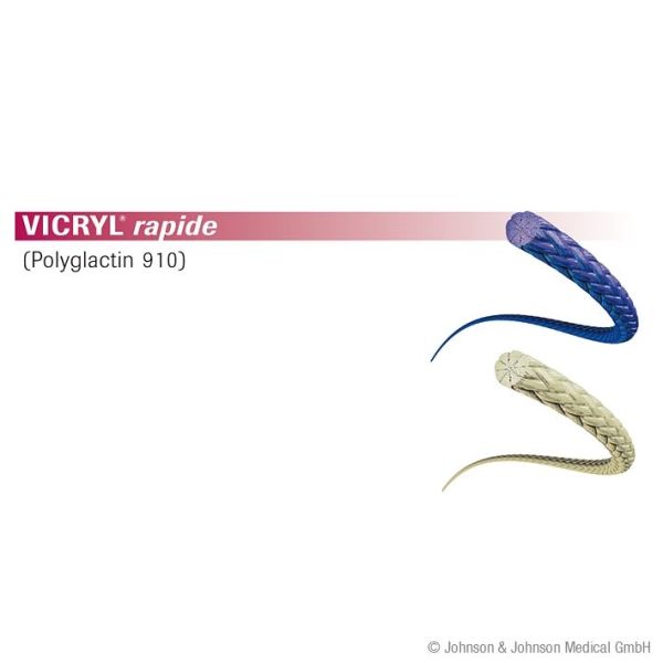 VICRYL rapide FS2 3/0=2 ungefärbt Nahtmaterial Fadenlänge 45 cm (36 Stck.)