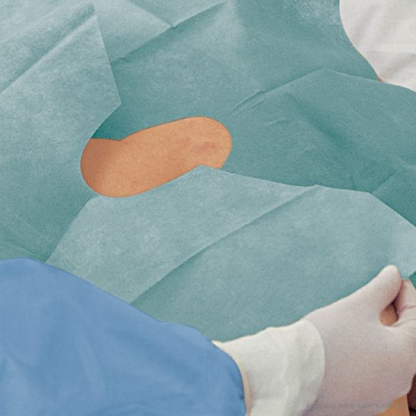 Foliodrape Protect Lochtücher steril selbstkl. 2lagig  45x75cm (65x2 Stck.)