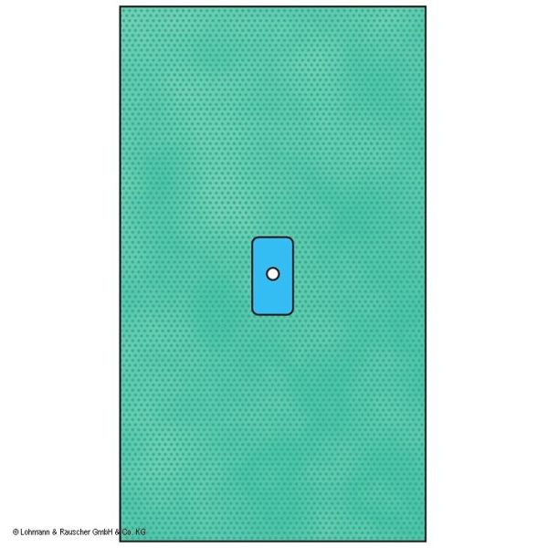 Raucodrape PRO Extremitätentücher Hand/Fuß steril