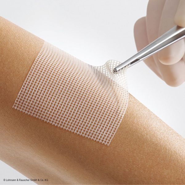 Lomatuell PRO Polyesterfaser-Gittertüll steril