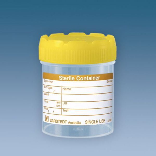 Mehrzweckbecher 70 ml mit montiertem Schraubverschluss gelb (200 Stck.)