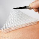 Lomatuell H Wundauflagen steril