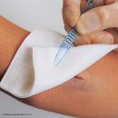 Vliwasoft Stoma unsteril, 4-lagig