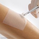 Lomatuell PRO Polyesterfaser-Gittertüll steril