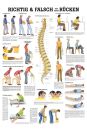 anat. Lehrtafel: Richtig & Falsch für Ihren Rücken 70 x 100 cm
